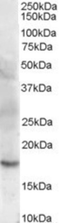 Cofilin 2 Antibody, Novus Biologicals 0.1mg; Unlabeled:Antikroppar