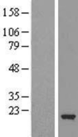 Novus Biologicals™ Cofilin 2 Overexpression Lysate