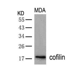 Cofilin Antibody, Novus Biologicals:Antibodies:Primary Antibodies