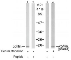 Cofilin Antibody, Novus Biologicals:Antibodies:Primary Antibodies