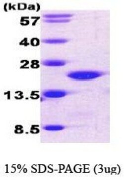 Novus Biologicals&trade;&nbsp;Recombinant Human Cofilin His Protein