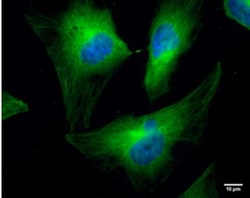 Cofilin Antibody (567), Novus Biologicals 0.1mL; Unlabeled:Antibodies,