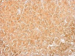 Cofilin Antibody (567), Novus Biologicals 0.1mL; Unlabeled:Antibodies,