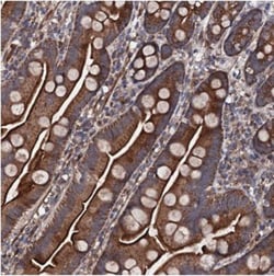 COG4 Antibody, Novus Biologicals:Antibodies:Primary Antibodies