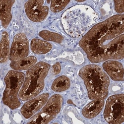 Coiled-Coil Domain Containing 149 Antibody, Novus Biologicals 0.1mL; Unlabeled:Antibodies,