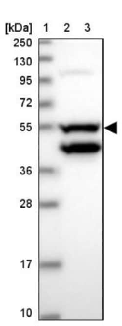 Coiled-Coil Domain Containing 149 Antibody, Novus Biologicals 0.1mL; Unlabeled:Antibodies,