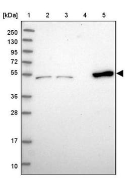 Coiled-Coil Domain Containing 149 Antibody, Novus Biologicals 0.1mL; Unlabeled:Antibodies,