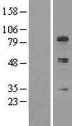 Novus Biologicals&trade;&nbsp;Collagen XIII alpha 1 Overexpression Lysate