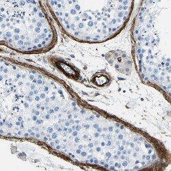 COL15A1 Antibody, Novus Biologicals:Antibodies:Primary Antibodies