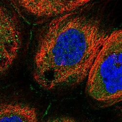DGK-theta Antibody, Novus Biologicals:Antibodies:Primary Antibodies