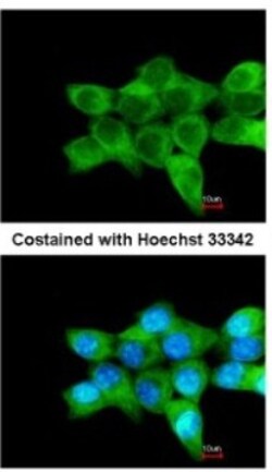 COL4A3BP Antibody, Novus Biologicals 0.1mL; Unlabeled:Antibodies, Polyclonal