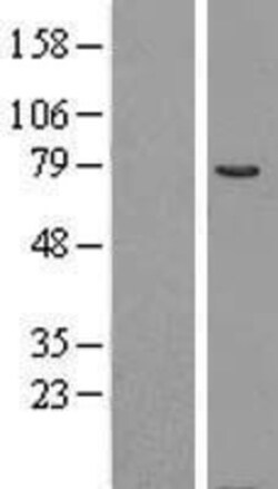 Novus Biologicals&trade;&nbsp;COL4A3BP Overexpression Lysate