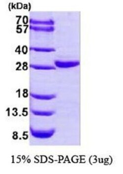 Novus Biologicals&trade;&nbsp;Recombinant Human COL4A3BP His Protein