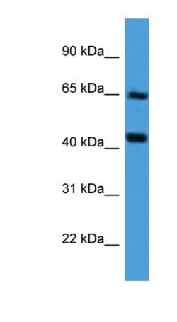 COL8A2 Antibody, Novus Biologicals 100&mu;L; Unlabeled:Antibodies, Polyclonal