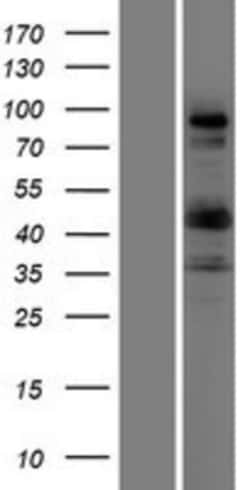 Novus Biologicals&trade;&nbsp;COL9A1 Overexpression Lysate