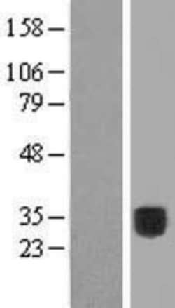 Novus Biologicals™ COLEC10 Overexpression Lysate