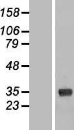 Novus Biologicals&trade;&nbsp;CL-K1/COLEC11 Overexpression Lysate