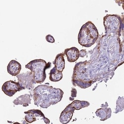 CL-P1/COLEC12 Antibody, Novus Biologicals 25 &mu;L, Unlabeled:Antibodies,
