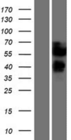 Novus Biologicals&trade;&nbsp;Collagen I alpha 1 Overexpression Lysate