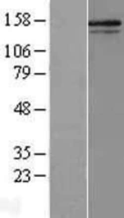 Novus Biologicals&trade;&nbsp;Collagen V alpha 2 Overexpression Lysate