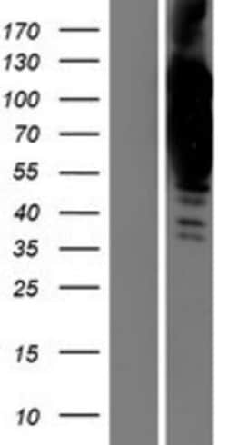 Novus Biologicals™ Collagen VI alpha 2 Overexpression Lysate