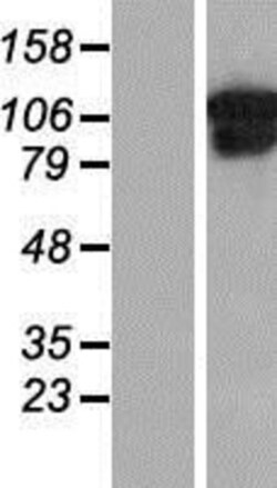 Novus Biologicals&trade;&nbsp;Collagen VI alpha 1 Overexpression Lysate