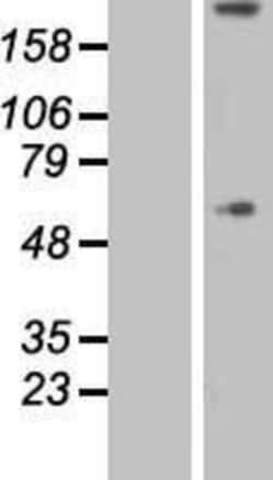 Novus Biologicals&trade;&nbsp;Collagen VIII alpha 1 Overexpression Lysate