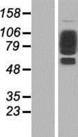 Novus Biologicals&trade;&nbsp;Collagen XXI Overexpression Lysate