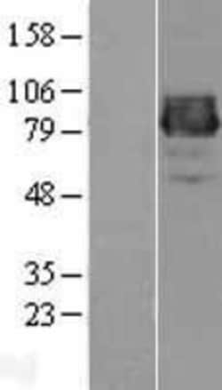 Novus Biologicals&trade;&nbsp;Collagen XXV alpha 1 Overexpression Lysate