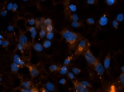 Collagen III alpha 1/COL3A1 Antibody, Novus Biologicals:Antibodies:Primary