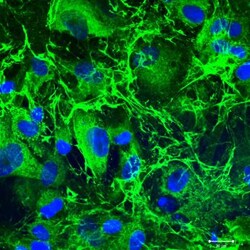 Collagen III alpha 1/COL3A1 Antibody, Novus Biologicals:Antibodies:Primary