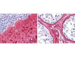 Collagen III alpha 1/COL3A1 Antibody, Novus Biologicals:Antibodies:Primary