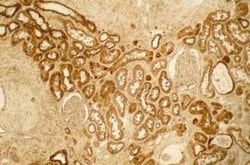 Collagen III alpha 1/COL3A1 Antibody, Novus Biologicals:Antibodies:Primary