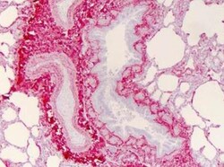 Collagen III alpha 1/COL3A1 Antibody, Novus Biologicals:Antibodies:Primary