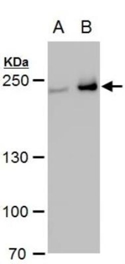 Collagen III alpha 1/COL3A1 Antibody, Novus Biologicals 0.1mL; Unlabeled:Antibodies,