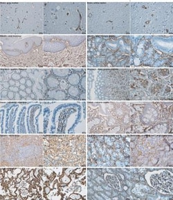 Collagen IV Antibody, Novus Biologicals 0.1mg; Unlabeled:Antibodies, Polyclonal