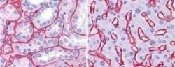 Collagen IV Antibody, Novus Biologicals 0.1mg; Unlabeled:Antibodies, Polyclonal