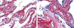 Collagen V Antibody, Novus Biologicals 0.1mg; Unlabeled:Antibodies, Polyclonal