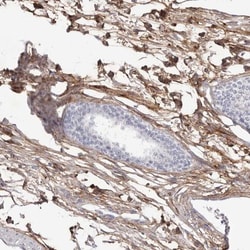 Collagen VI alpha 1 Antibody, Novus Biologicals 0.1 mL | Buy Online | Novus Biologicals | Fisher Scientific