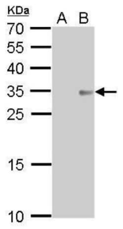 Collagen XI alpha 2 Antibody (212), Novus Biologicals 0.1mL; Unlabeled:Antibodies,