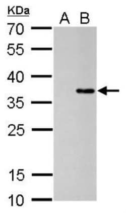 Collagen XI alpha 2 Antibody (473), Novus Biologicals 0.1mL; Unlabeled:Antikörper