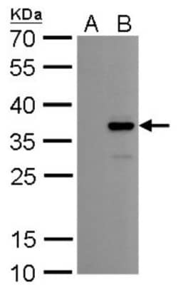 Collagen XI alpha 2 Antibody (6410), Novus Biologicals 0.1mL; Unlabeled:Antibodies,