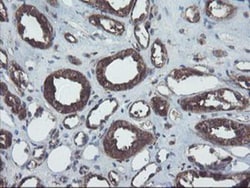 COMMD1 Antibody (OTI1F2), Novus Biologicals 0.1mL; Unlabeled:Antibodies,