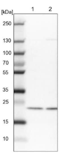 COMMD2 Antibody, Novus Biologicals 0.1mL; Unlabeled:Antibodies, Polyclonal