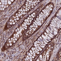 COMMD2 Antibody, Novus Biologicals 0.1mL; Unlabeled:Antibodies, Polyclonal