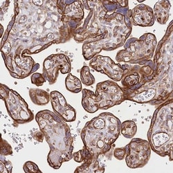 COMMD3 Antibody, Novus Biologicals 0.1mL; Unlabeled:Antibodies, Polyclonal