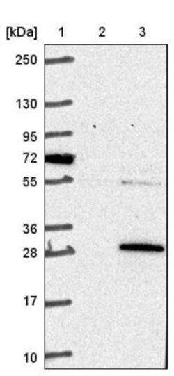 COMMD3 Antibody, Novus Biologicals 0.1mL; Unlabeled:Antibodies, Polyclonal