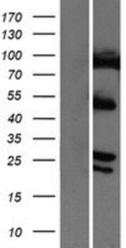 Novus Biologicals™ COMMD4 Overexpression Lysate