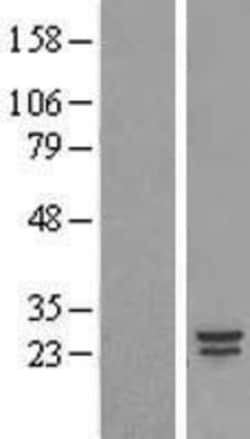 Novus Biologicals&trade;&nbsp;COMMD5 Overexpression Lysate