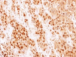 COMMD7 Antibody, Novus Biologicals 0.1mg; Unlabeled:Antibodies, Polyclonal